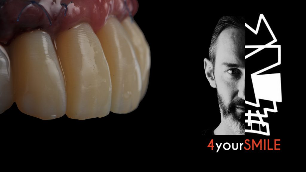 Cas clinique 1