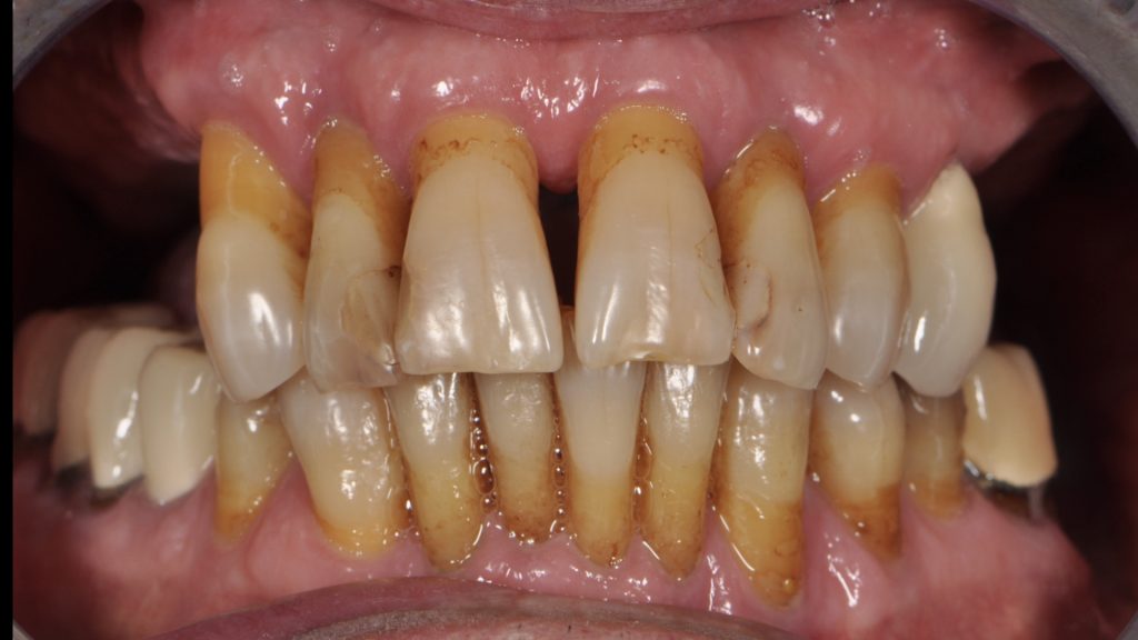 Cas clinique 1