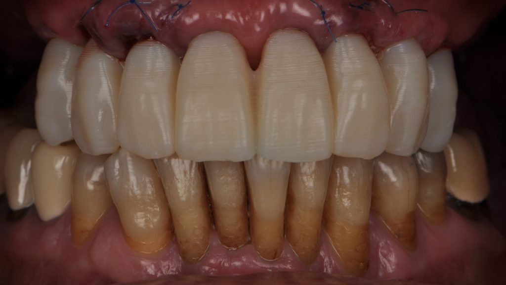 Cas clinique 1