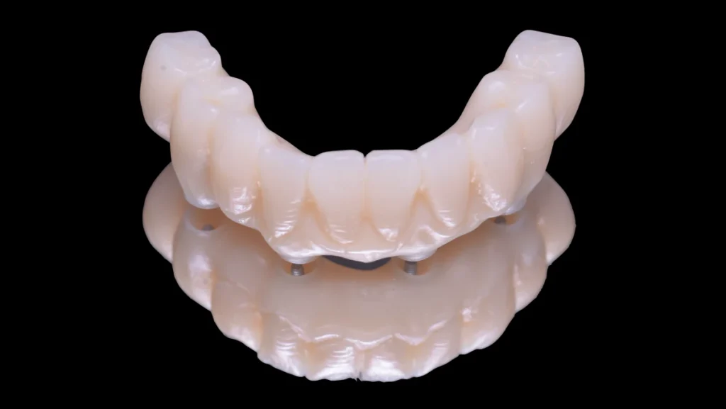 Réhabilitation complète bi-maxillaire
