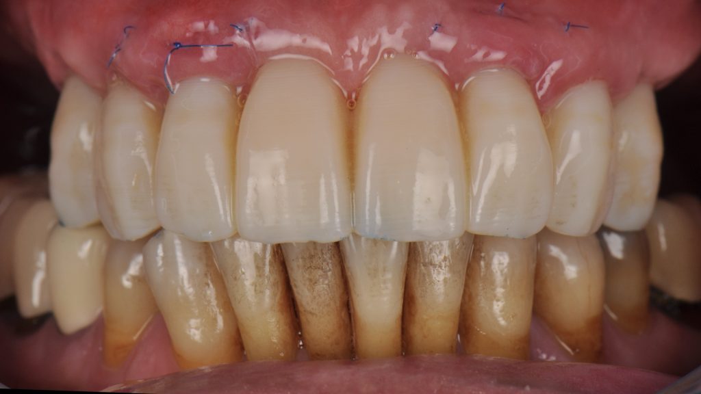 Cas clinique 1