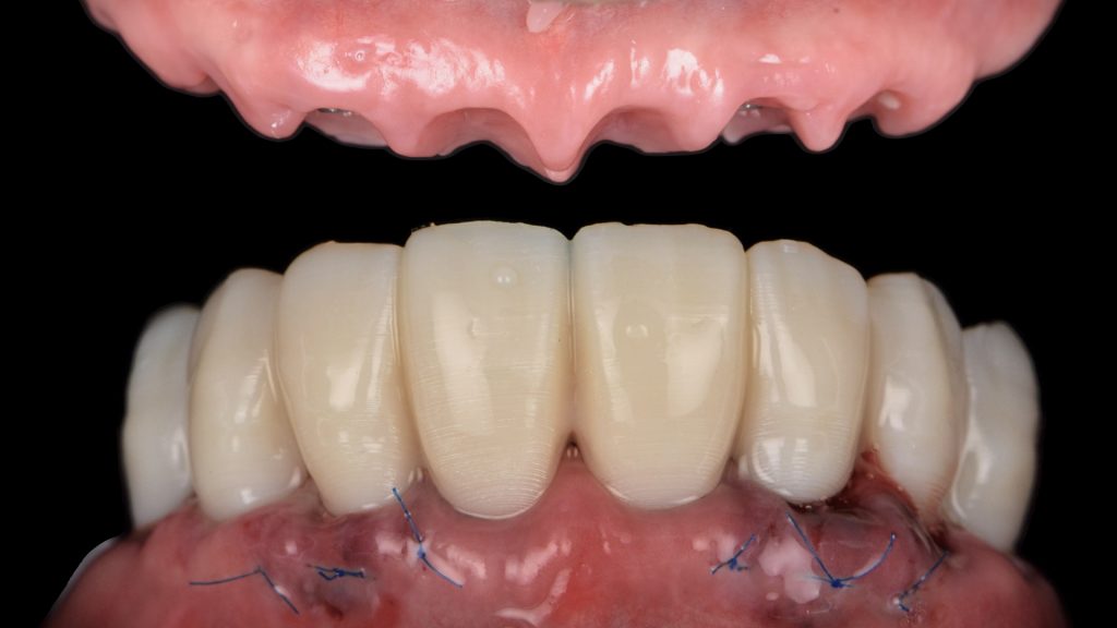 Cas clinique 1
