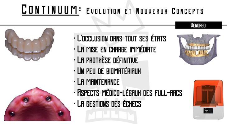 Réhabilitation implanto-prothétique de l'édenté complet : Concept du Full-Arch - LILLE